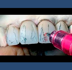 Laboratorio Dental Arcodent cerámica