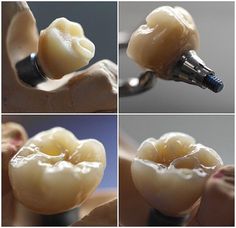 Laboratorio Dental Arcodent dientes