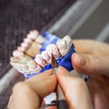 Laboratorio Dental Arcodent prótesis dentales 