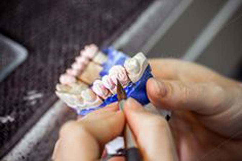 Laboratorio Dental Arcodent prótesis dentales 
